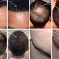 💞Only Today Buy 1 Get 1 Free!!💞🔥Hairline Powder - Instant Coverage for Thinning or Balding Areas